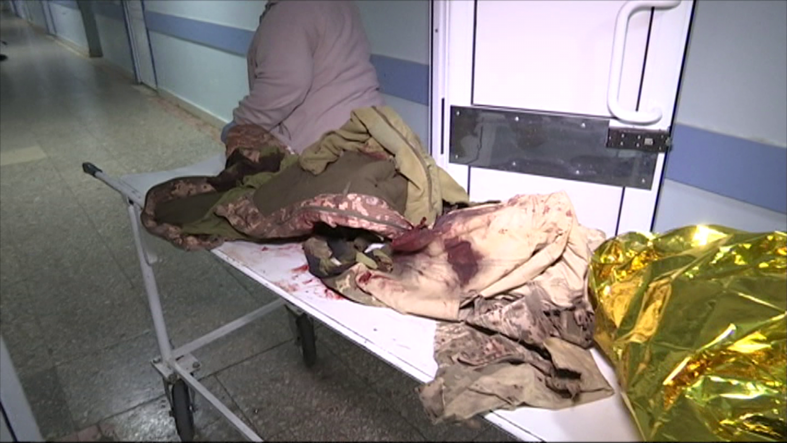 Одяг поранених у лікарні невідкладної допомоги