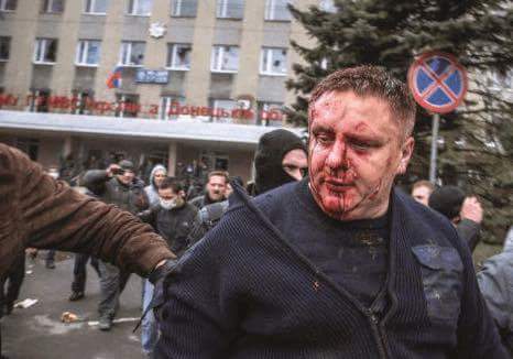Андрей Крищенко после нападения сепаратистов