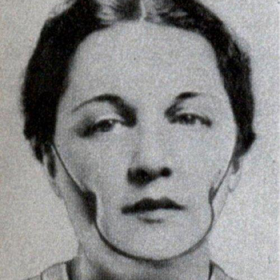 С помощью вот такого приспособления женщины пытались обзавестись ямочками на щеках, 1936 год